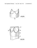 PROSTHETIC HEART VALVE AND METHOD diagram and image