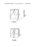 PROSTHETIC HEART VALVE AND METHOD diagram and image