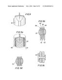 PROSTHETIC HEART VALVE AND METHOD diagram and image