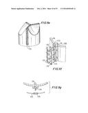 PROSTHETIC HEART VALVE AND METHOD diagram and image