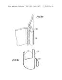 PROSTHETIC HEART VALVE AND METHOD diagram and image