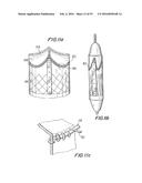 PROSTHETIC HEART VALVE AND METHOD diagram and image