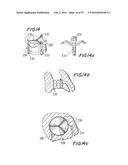 PROSTHETIC HEART VALVE AND METHOD diagram and image