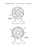 PROSTHETIC HEART VALVE AND METHOD diagram and image