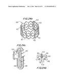 PROSTHETIC HEART VALVE AND METHOD diagram and image