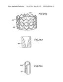 PROSTHETIC HEART VALVE AND METHOD diagram and image