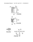 PROSTHETIC HEART VALVE AND METHOD diagram and image