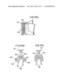 PROSTHETIC HEART VALVE AND METHOD diagram and image