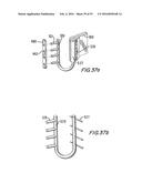 PROSTHETIC HEART VALVE AND METHOD diagram and image