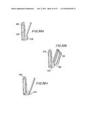 PROSTHETIC HEART VALVE AND METHOD diagram and image