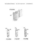 PROSTHETIC HEART VALVE AND METHOD diagram and image