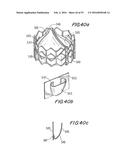 PROSTHETIC HEART VALVE AND METHOD diagram and image