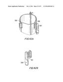 PROSTHETIC HEART VALVE AND METHOD diagram and image