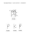 PROSTHETIC HEART VALVE AND METHOD diagram and image