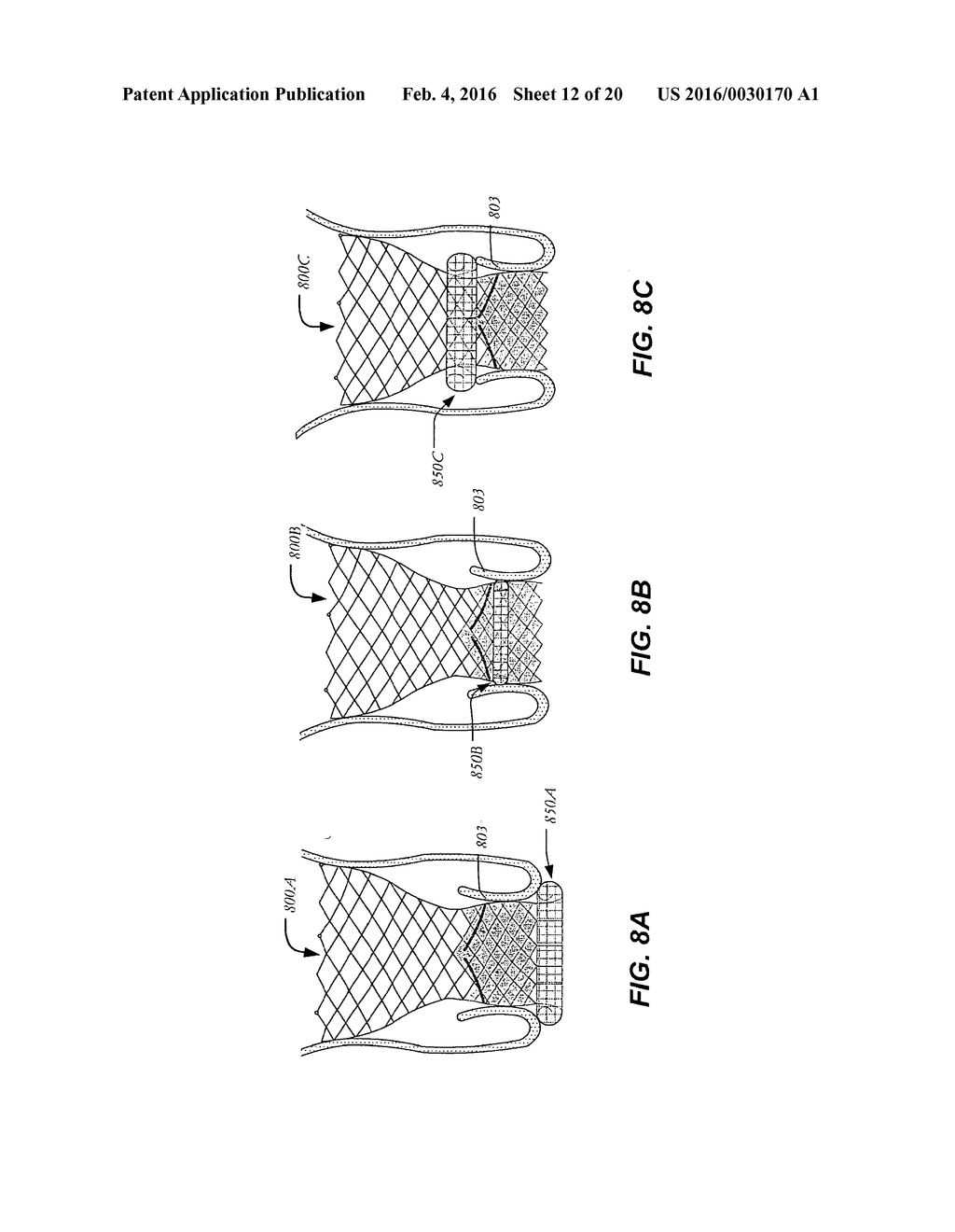 SELF-ACTUATING SEALING PORTIONS FOR A PARAVALVULAR LEAK PROTECTION - diagram, schematic, and image 13