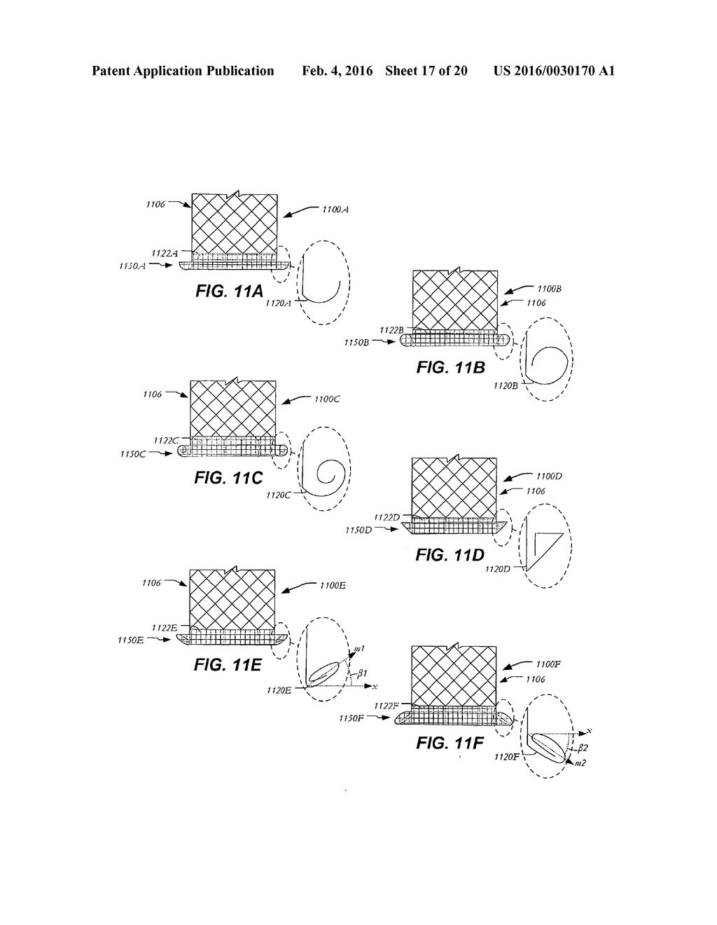 SELF-ACTUATING SEALING PORTIONS FOR A PARAVALVULAR LEAK PROTECTION - diagram, schematic, and image 18