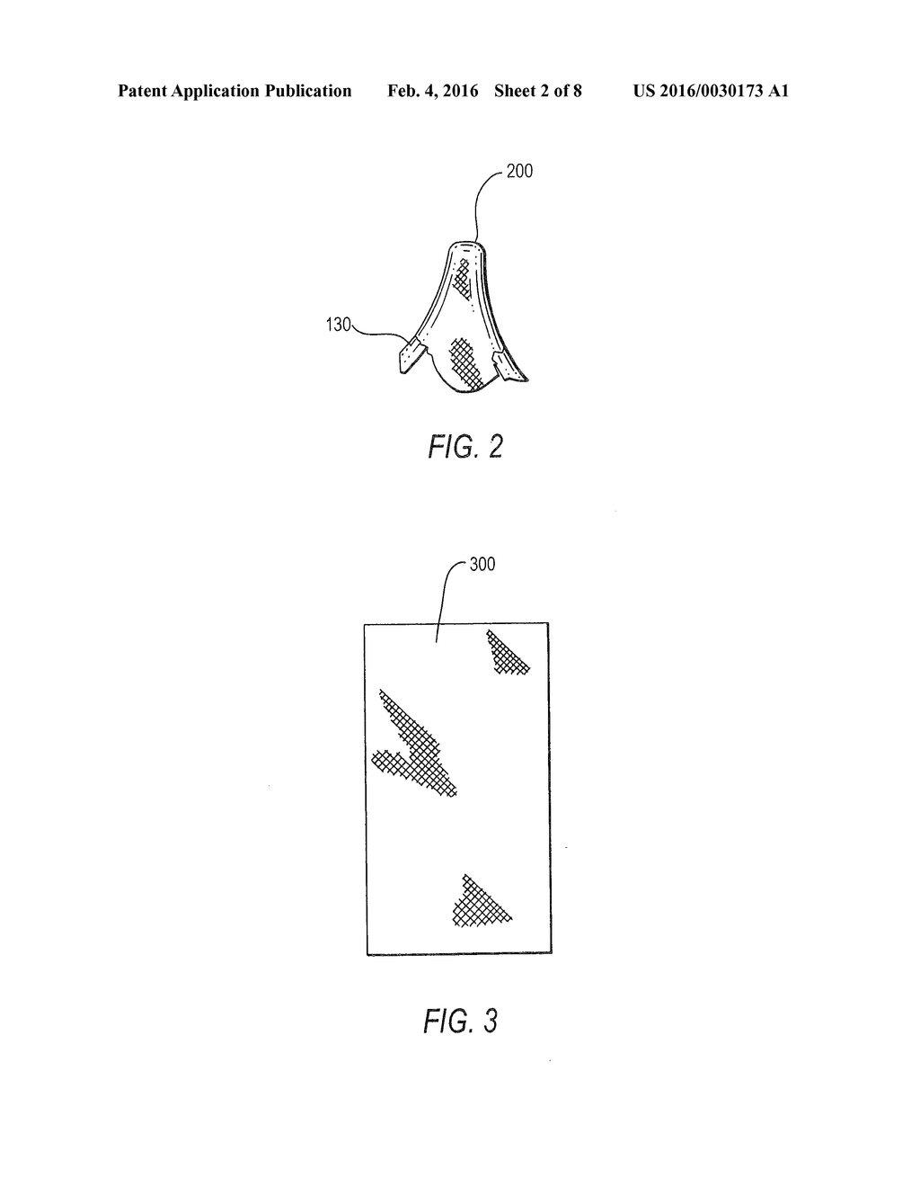 PROSTHETIC HEART VALVE INCLUDING STENT STRUCTURE AND TISSUE LEAFLETS, AND     RELATED METHODS - diagram, schematic, and image 03