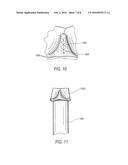 PROSTHETIC HEART VALVE INCLUDING STENT STRUCTURE AND TISSUE LEAFLETS, AND     RELATED METHODS diagram and image