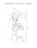 MODULAR FEMORAL PROVISIONAL diagram and image