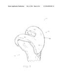 MODULAR FEMORAL PROVISIONAL diagram and image