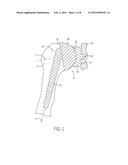 SHOULDER PROSTHESIS WITH VARIABLE INCLINATION HUMERAL HEAD COMPONENT diagram and image