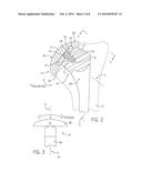 SHOULDER PROSTHESIS WITH VARIABLE INCLINATION HUMERAL HEAD COMPONENT diagram and image