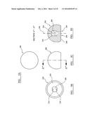 IMPLANT TRIALLING diagram and image