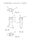 IMPLANT TRIALLING diagram and image