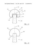 IMPLANT TRIALLING diagram and image