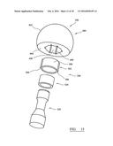 IMPLANT TRIALLING diagram and image