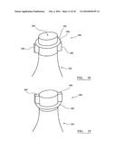 IMPLANT TRIALLING diagram and image