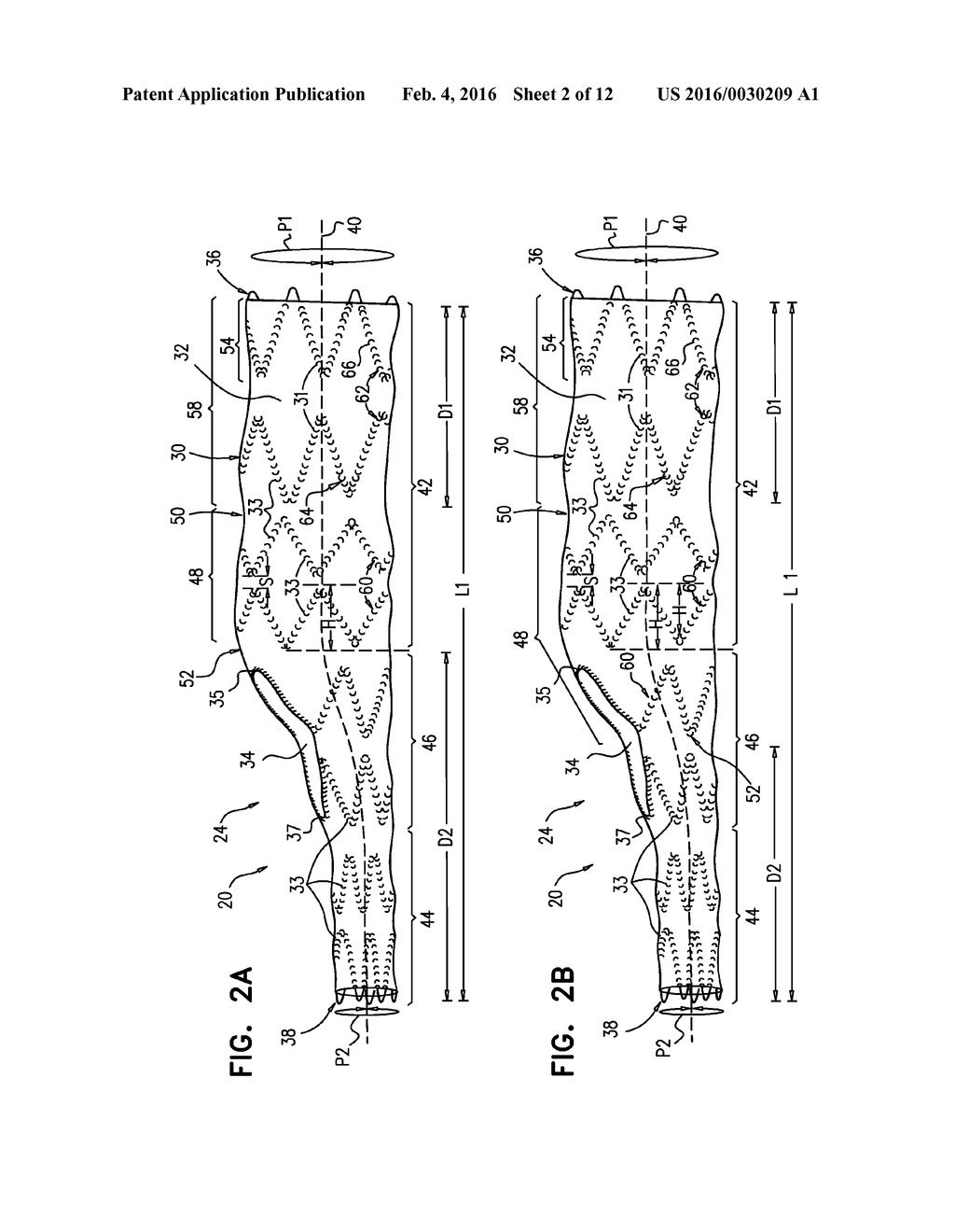 MULTI-COMPONENT STENT-GRAFT SYSTEM FOR AORTIC DISSECTIONS - diagram, schematic, and image 03