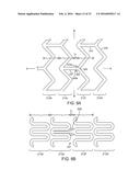 Crush Recoverable Polymer Scaffolds diagram and image