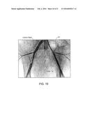 Crush Recoverable Polymer Scaffolds diagram and image