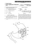 Magnetic Device To Control Obesity And Related Method Of Use diagram and image