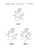 WOUND DRESSING ASSEMBLY diagram and image