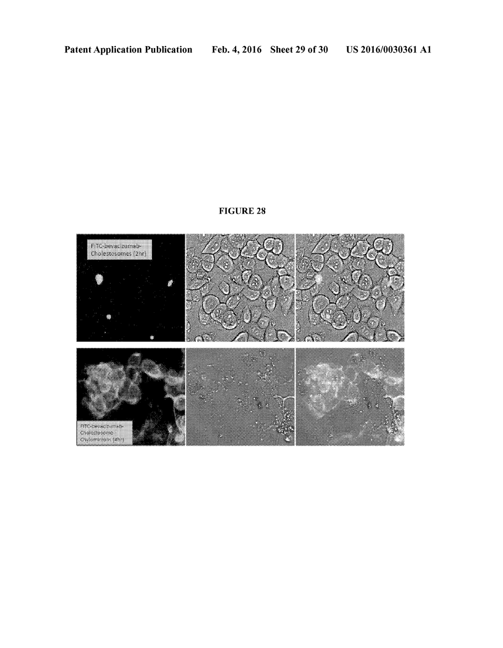 CHOLESTOSOME VESICLES FOR INCORPORATION OF MOLECULES INTO CHYLOMICRONS - diagram, schematic, and image 30