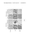 COMPOSITION AND METHOD FOR TREATING OR PREVENTING SKELETAL MUSCLE FIBROSIS diagram and image