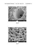 USE OF MICROPARTICLES AND ENDOTHELIAL CELLS WITH DECELLULARIZED ORGANS AND     TISSUES diagram and image