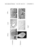 USE OF MICROPARTICLES AND ENDOTHELIAL CELLS WITH DECELLULARIZED ORGANS AND     TISSUES diagram and image