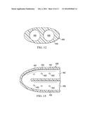 SYSTEMS AND METHODS FOR SUBCUTANEOUS ADMINISTRATION OF REDUCED PRESSURE     EMPLOYING RECONFIGURABLE LUMENS diagram and image