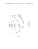 CATHETER PUMP ASSEMBLY INCLUDING A STATOR diagram and image