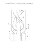 CATHETER PUMP ASSEMBLY INCLUDING A STATOR diagram and image