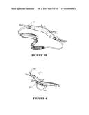 NASAL CANNULA ASSEMBLIES AND RELATED PARTS diagram and image