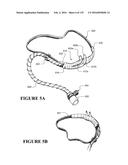 NASAL CANNULA ASSEMBLIES AND RELATED PARTS diagram and image