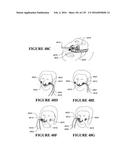 NASAL CANNULA ASSEMBLIES AND RELATED PARTS diagram and image