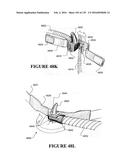 NASAL CANNULA ASSEMBLIES AND RELATED PARTS diagram and image