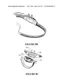 NASAL CANNULA ASSEMBLIES AND RELATED PARTS diagram and image