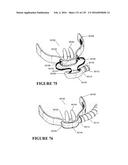 NASAL CANNULA ASSEMBLIES AND RELATED PARTS diagram and image