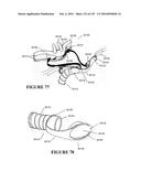 NASAL CANNULA ASSEMBLIES AND RELATED PARTS diagram and image